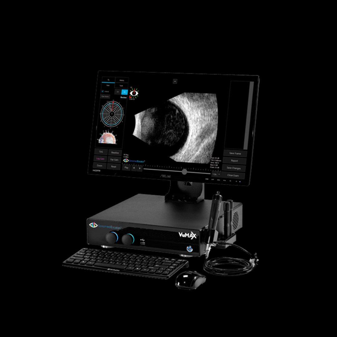 Ультразвуковий A-B Scan "Sonomed VuMax HD"