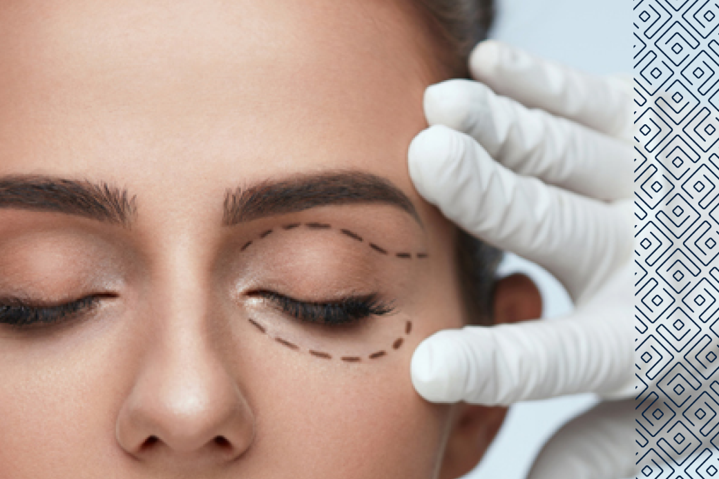 блефаропластика