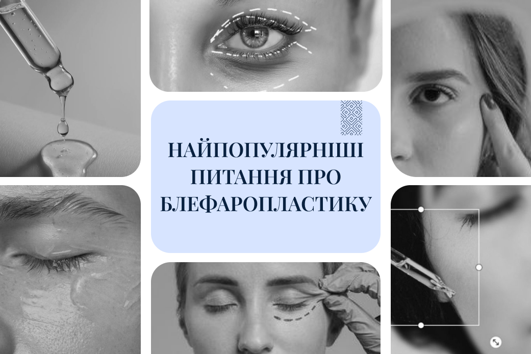 що таке блефаропластика