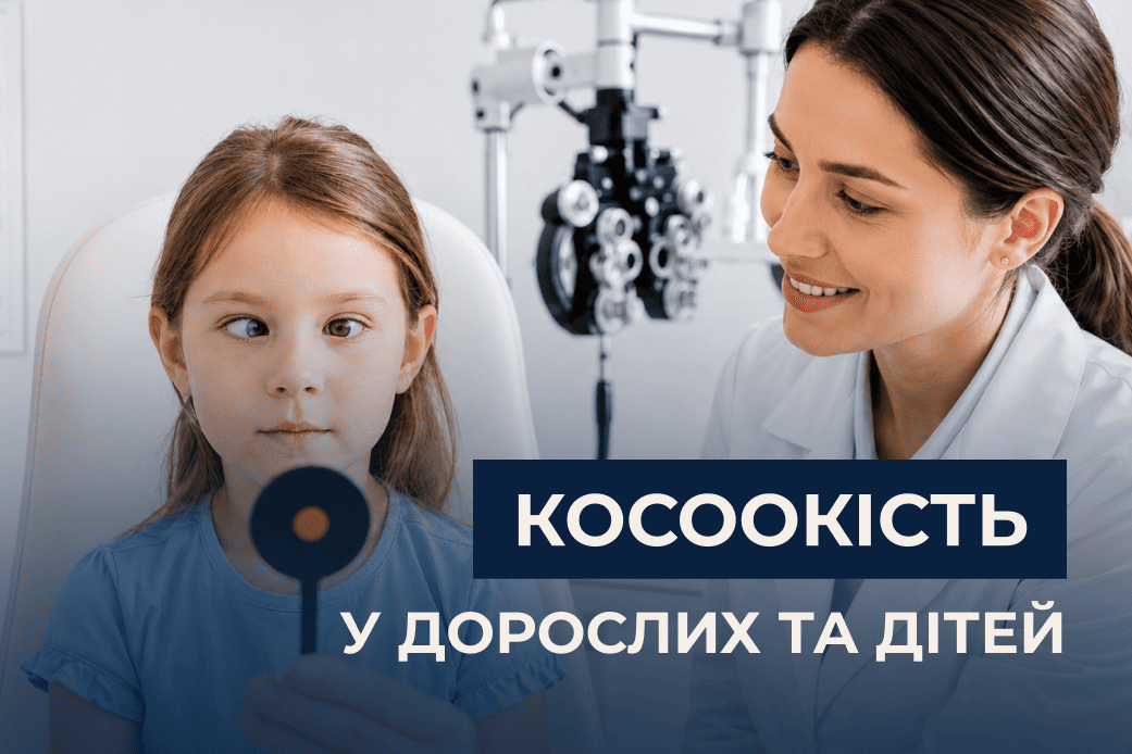 Косоокість у дорослих та дітей