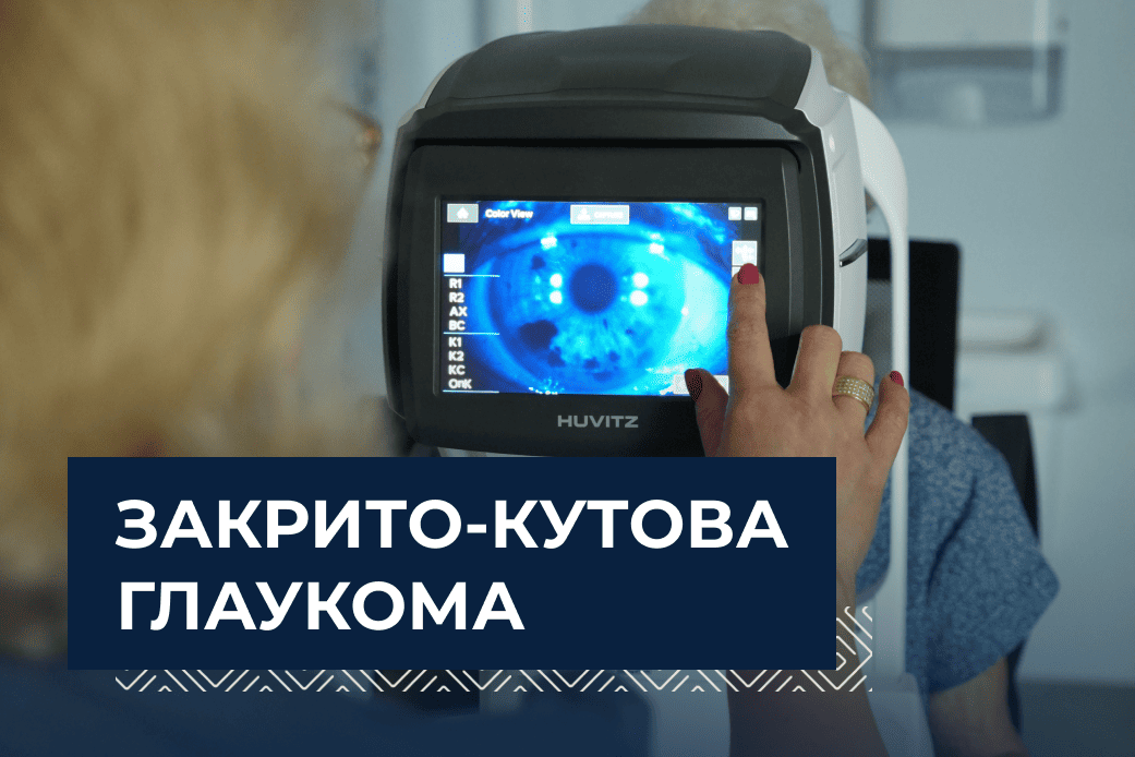 Закрито-кутова глаукома